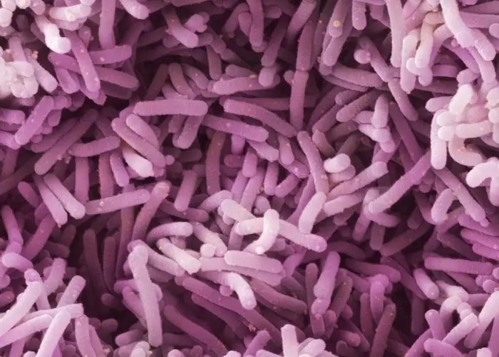 Lactobacillus casei