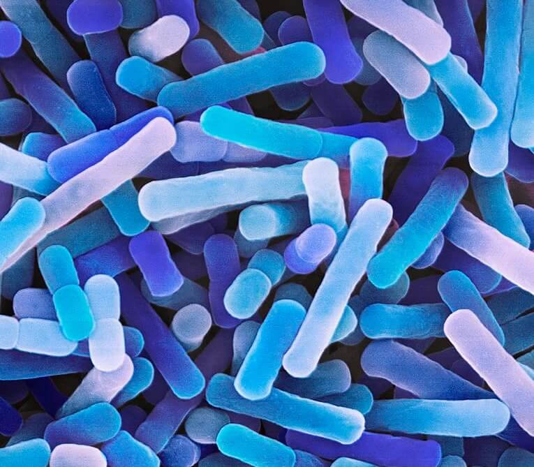 Lactobacillus bulgaricus