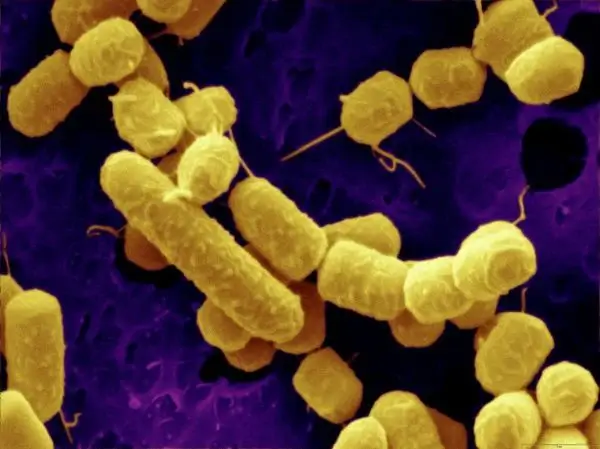 Lactobacillus plantarum