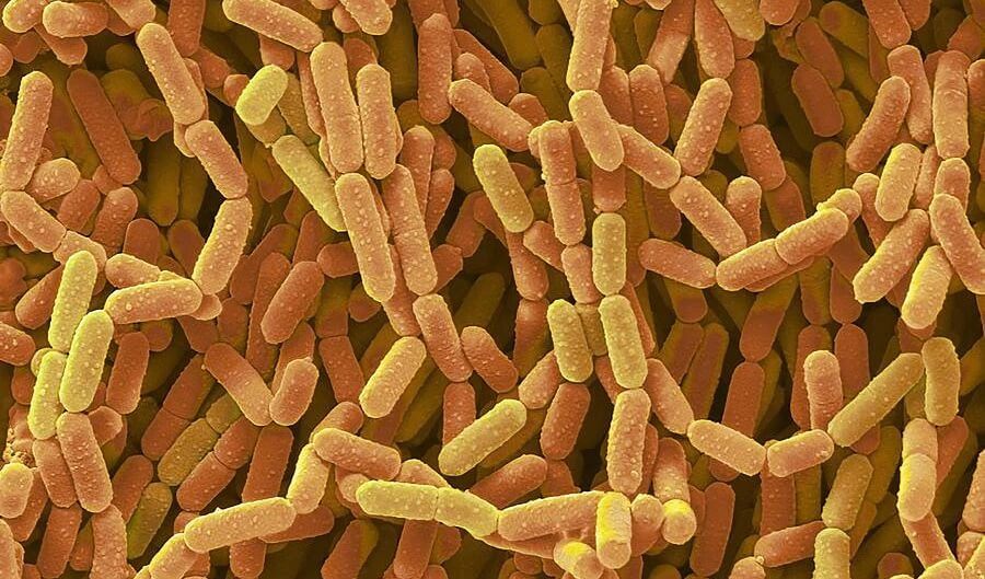 Lactobacillus rhamnosus