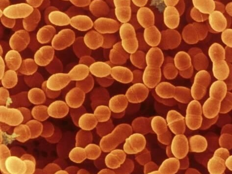 Streptococcus thermophilus